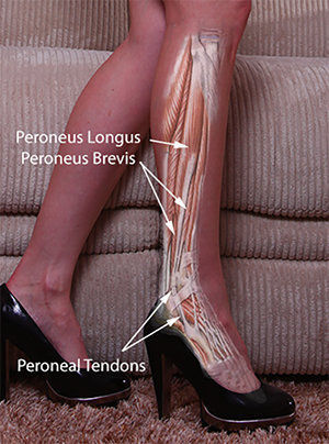 perone tibia gambe